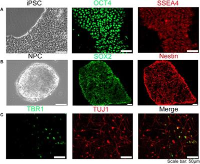 Uncovering the Functional Link Between SHANK3 Deletions and Deficiency in Neurodevelopment Using iPSC-Derived Human Neurons